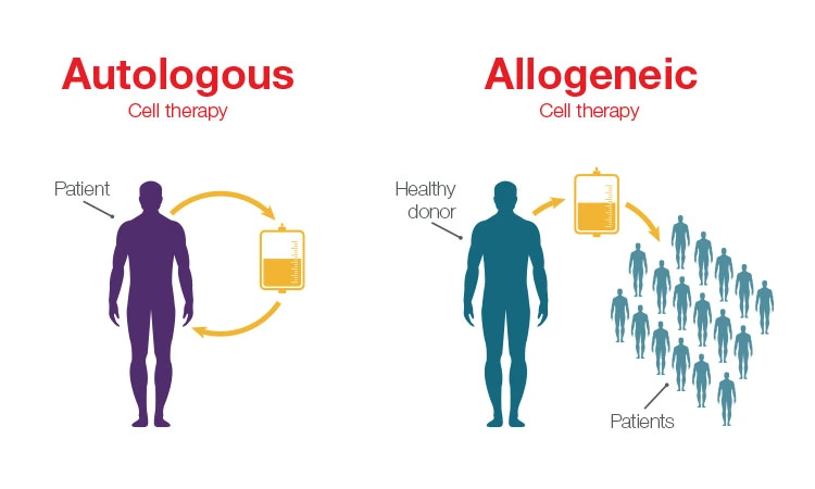 Autologous and Allogeneic cell therapy